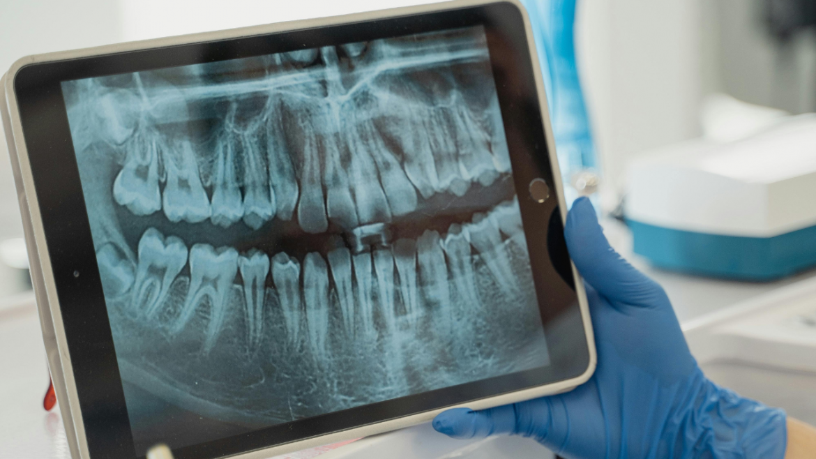 dental x-ray of teeth